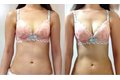 ジャックままこと戸瀬恭子の育乳サロン_thum1